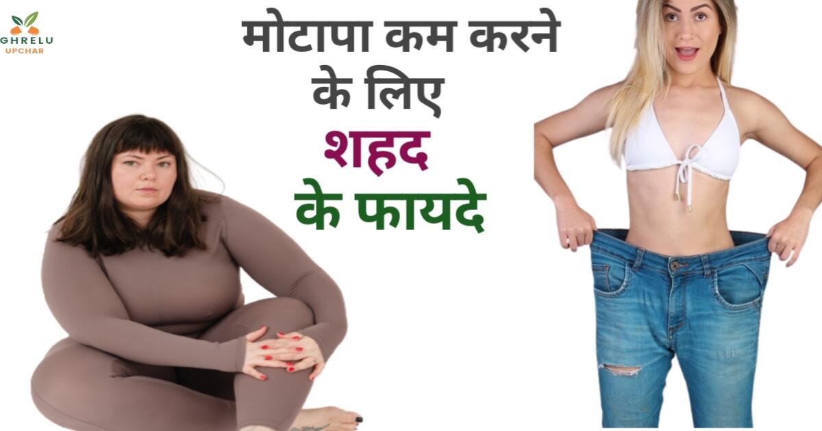 Best Remedies Honey: शहद खाने के फायदे और नुकसान Best Remedies Honey: शहद खाने के फायदे और नुकसान