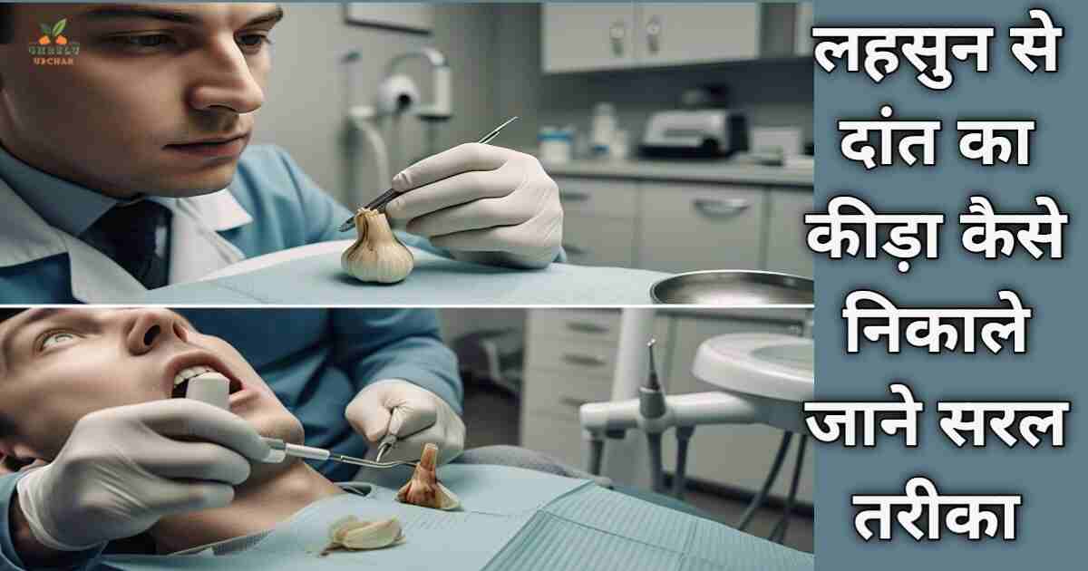 लहसुन से दांत का कीड़ा कैसे निकाले जाने 5 सरल घरेलू उपाय